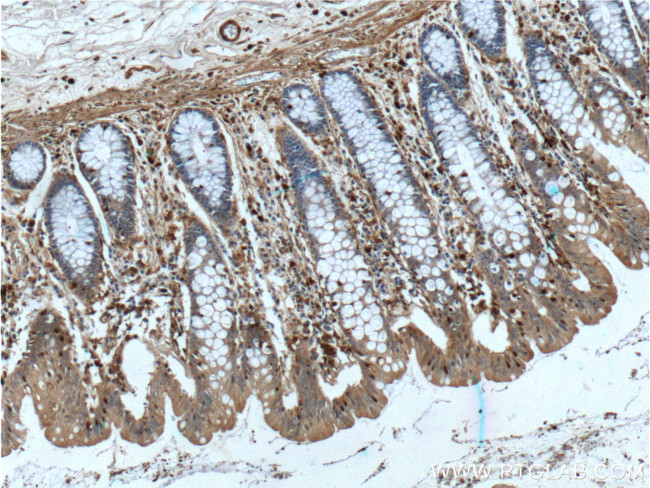 Gelsolin Antibody in Immunohistochemistry (Paraffin) (IHC (P))