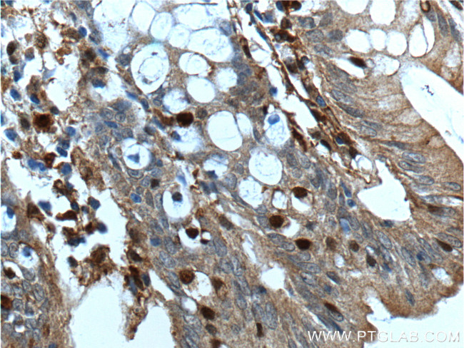 Gelsolin Antibody in Immunohistochemistry (Paraffin) (IHC (P))