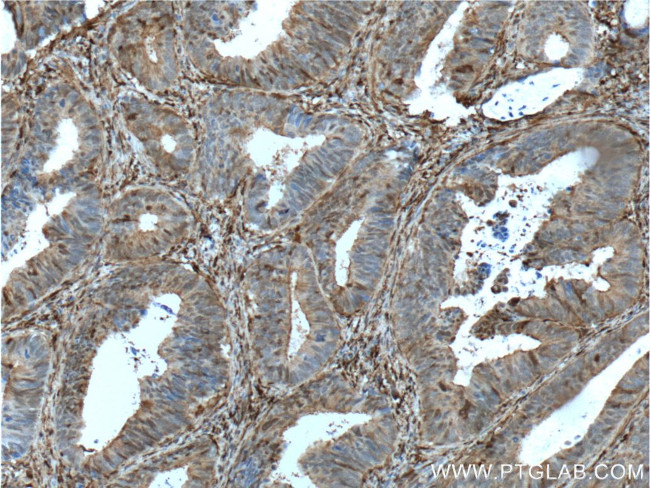 Gelsolin Antibody in Immunohistochemistry (Paraffin) (IHC (P))