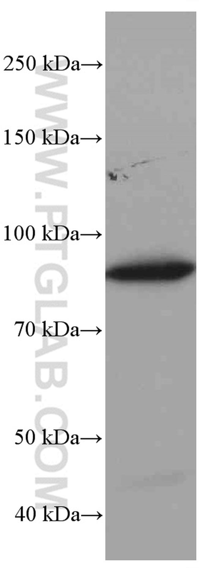 Gelsolin Antibody in Western Blot (WB)