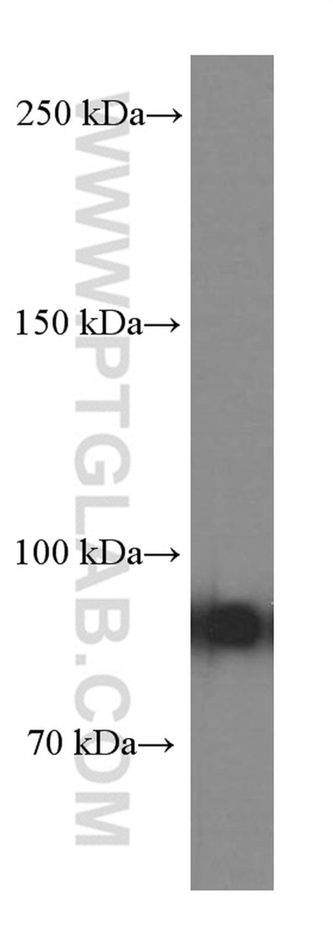 Gelsolin Antibody in Western Blot (WB)