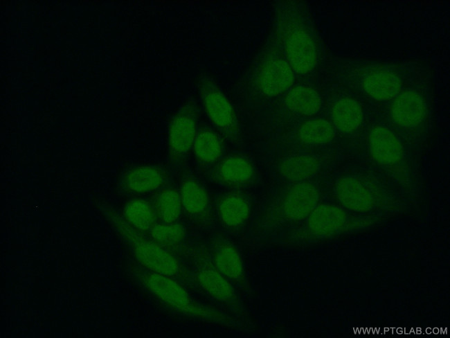 YY1 Antibody in Immunocytochemistry (ICC/IF)