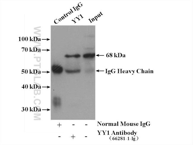 YY1 Antibody in Immunoprecipitation (IP)