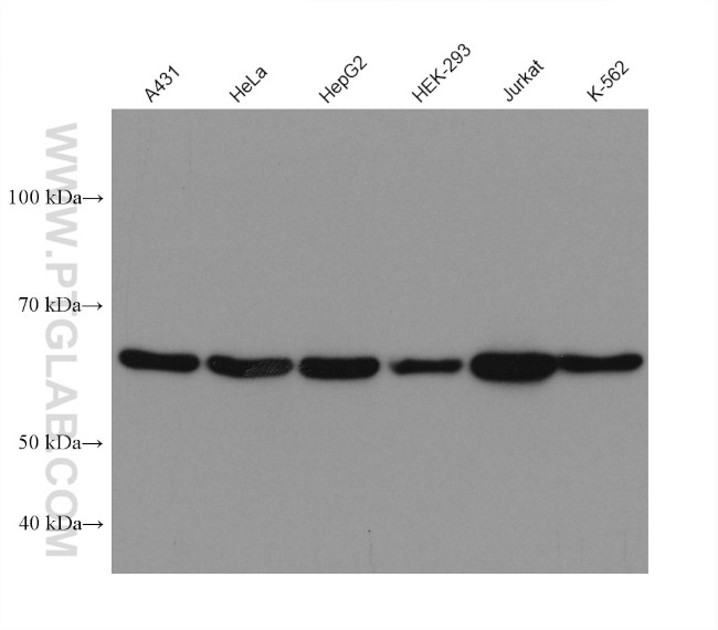 YY1 Antibody in Western Blot (WB)