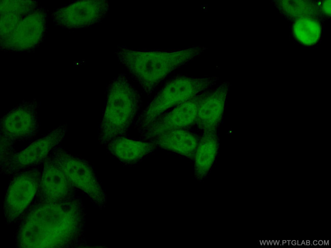 YY1 Antibody in Immunocytochemistry (ICC/IF)