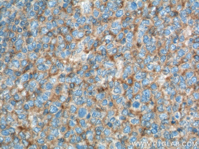 CD200 Antibody in Immunohistochemistry (Paraffin) (IHC (P))