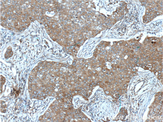 IGF1R beta chain Antibody in Immunohistochemistry (Paraffin) (IHC (P))