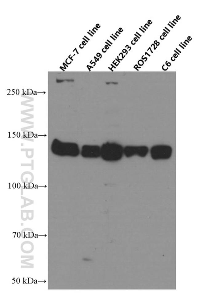 IGF1R beta chain Antibody in Western Blot (WB)