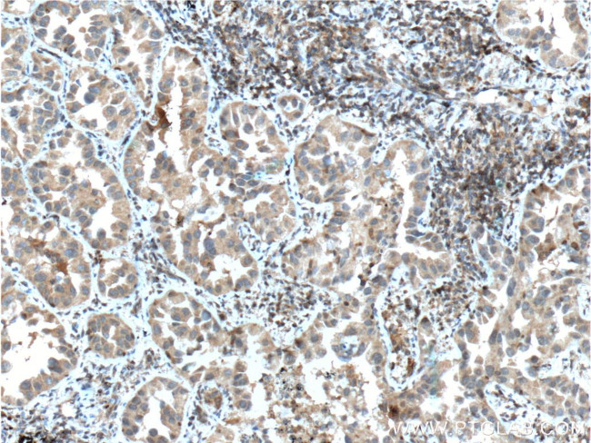 IGF1R beta chain Antibody in Immunohistochemistry (Paraffin) (IHC (P))