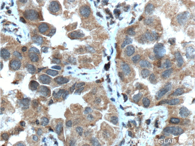 IGF1R beta chain Antibody in Immunohistochemistry (Paraffin) (IHC (P))