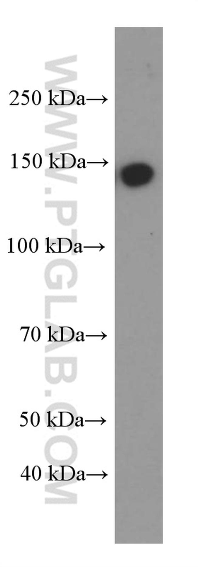 IGF1R beta chain Antibody in Western Blot (WB)