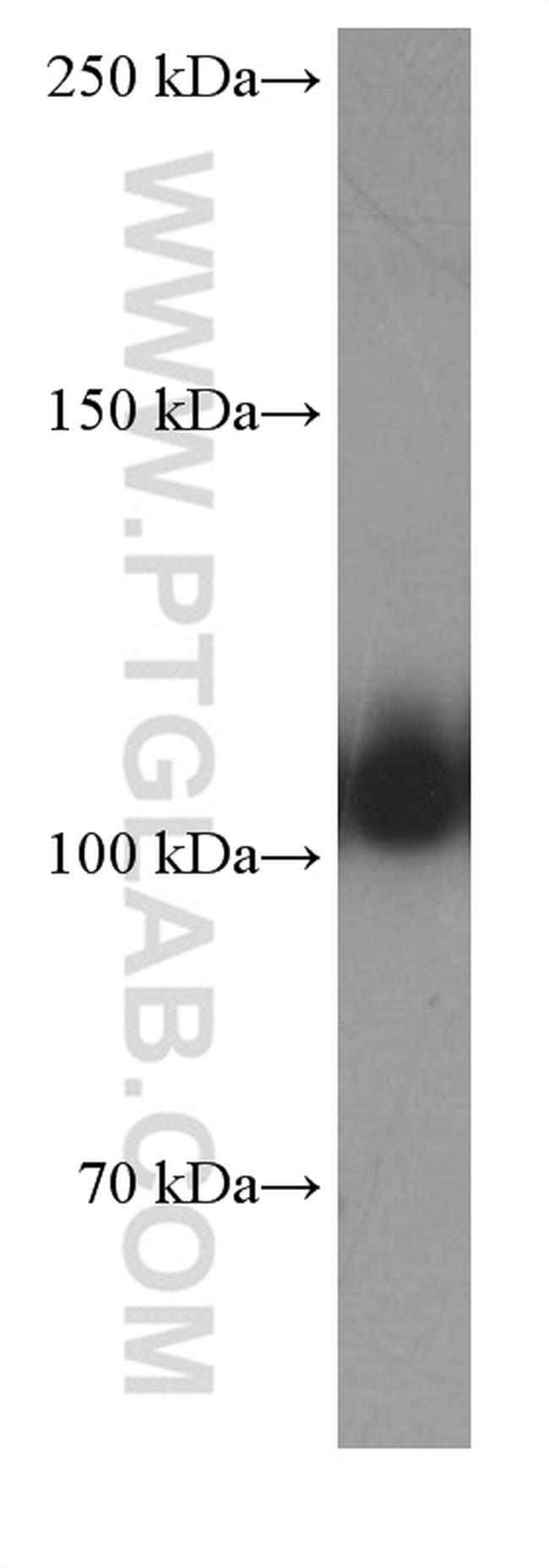 OGDH Antibody in Western Blot (WB)