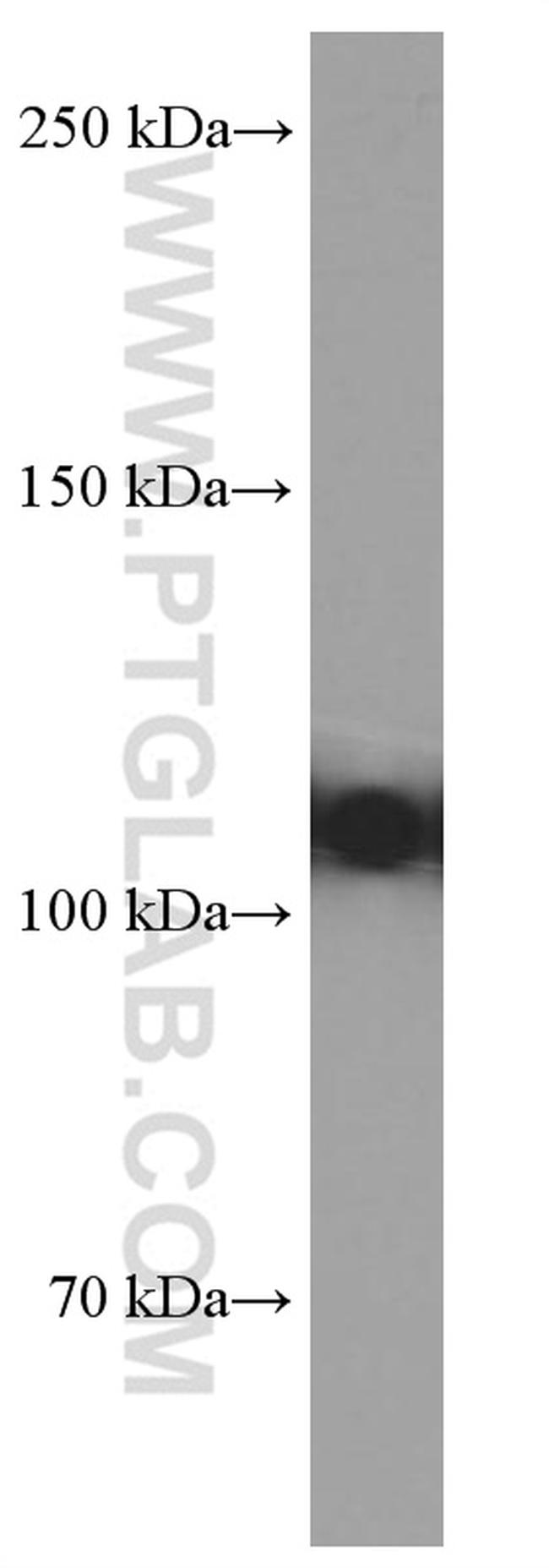 OGDH Antibody in Western Blot (WB)