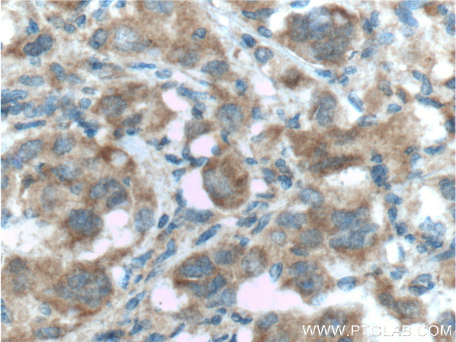 LDHA Antibody in Immunohistochemistry (Paraffin) (IHC (P))