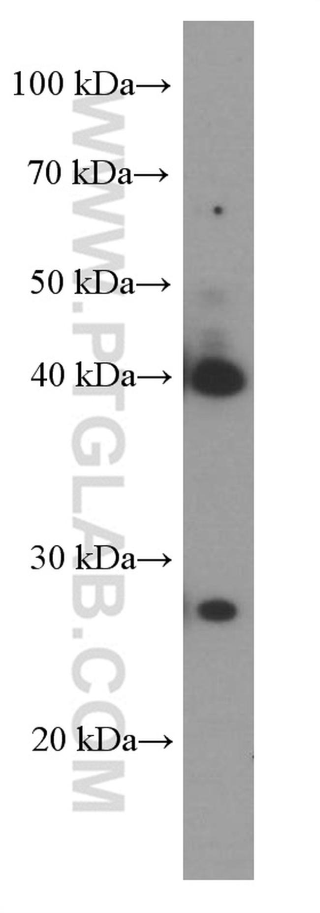 LDHA Antibody in Western Blot (WB)