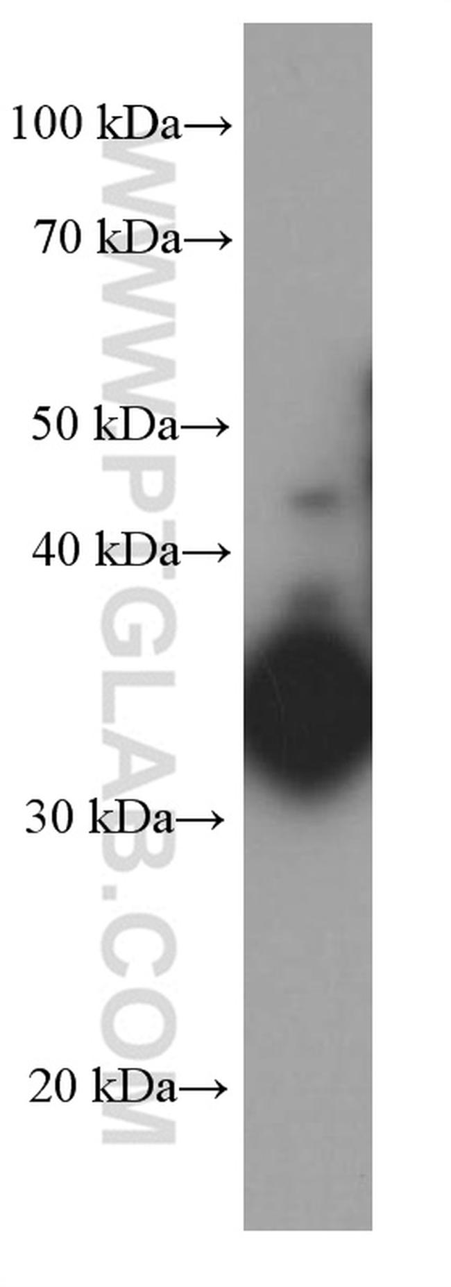 IL-12B Antibody in Western Blot (WB)