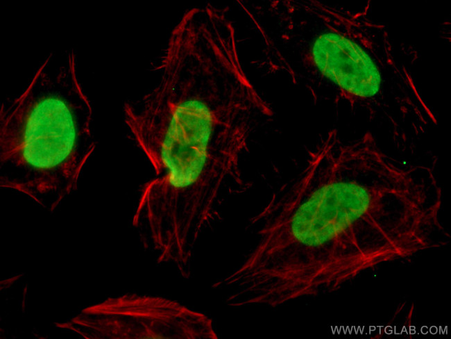 Pan Acetylation Antibody in Immunocytochemistry (ICC/IF)