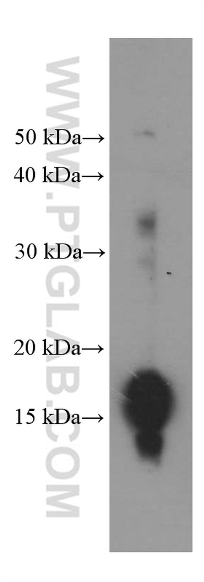 Pan Acetylation Antibody in Western Blot (WB)