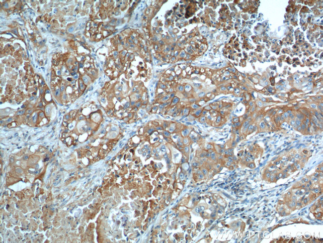 GLUT1 Antibody in Immunohistochemistry (Paraffin) (IHC (P))