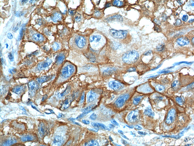 GLUT1 Antibody in Immunohistochemistry (Paraffin) (IHC (P))