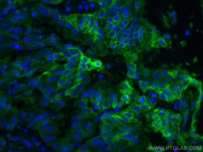 GLUT1 Antibody in Immunohistochemistry (PFA fixed) (IHC (PFA))