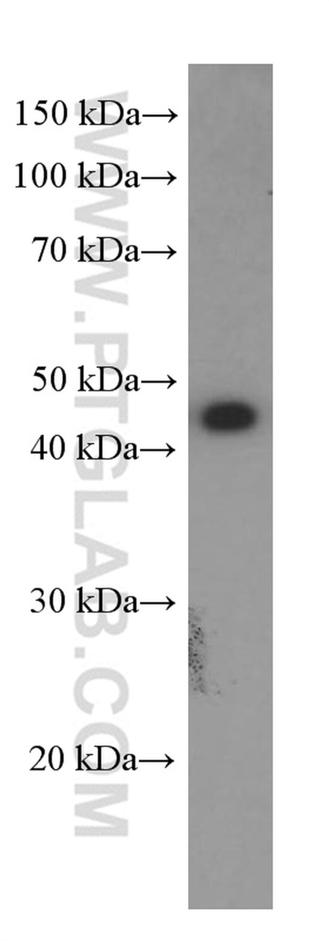 GLUT1 Antibody in Western Blot (WB)