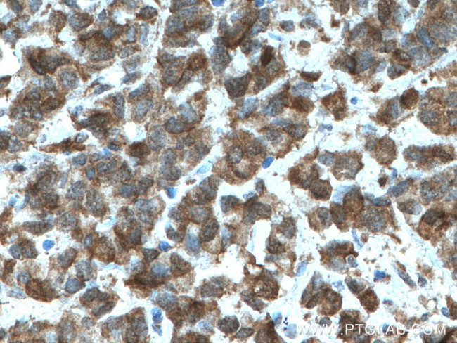 HSPA2 Antibody in Immunohistochemistry (Paraffin) (IHC (P))