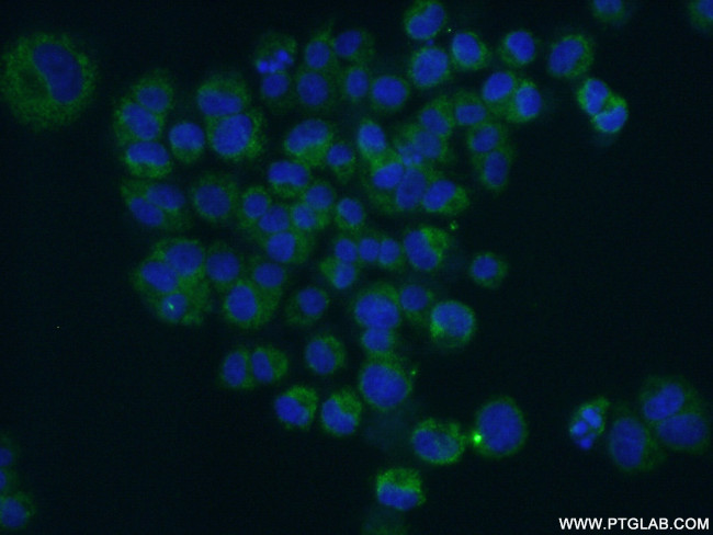 BDNF Antibody in Immunocytochemistry (ICC/IF)