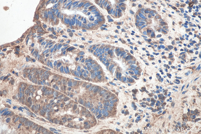 SETDB1 Antibody in Immunohistochemistry (Paraffin) (IHC (P))