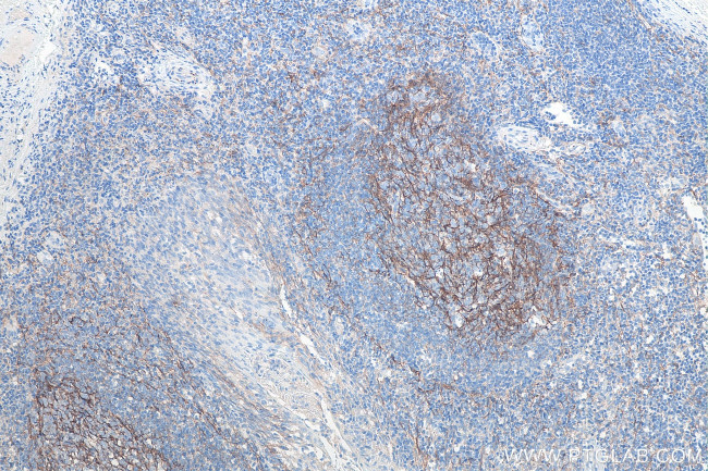 VCAM-1 Antibody in Immunohistochemistry (Paraffin) (IHC (P))