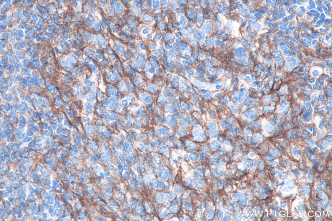 VCAM-1 Antibody in Immunohistochemistry (Paraffin) (IHC (P))