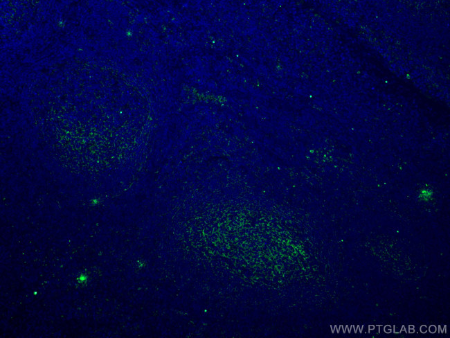 VCAM-1 Antibody in Immunohistochemistry (PFA fixed) (IHC (PFA))