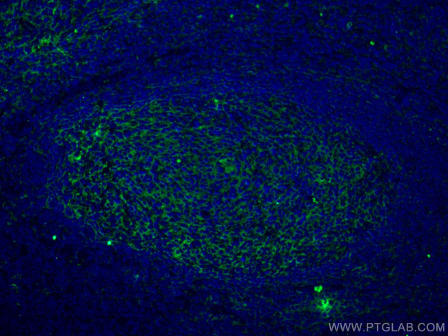 VCAM-1 Antibody in Immunohistochemistry (PFA fixed) (IHC (PFA))