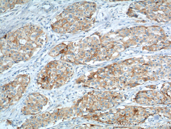 VCAM-1 Antibody in Immunohistochemistry (Paraffin) (IHC (P))