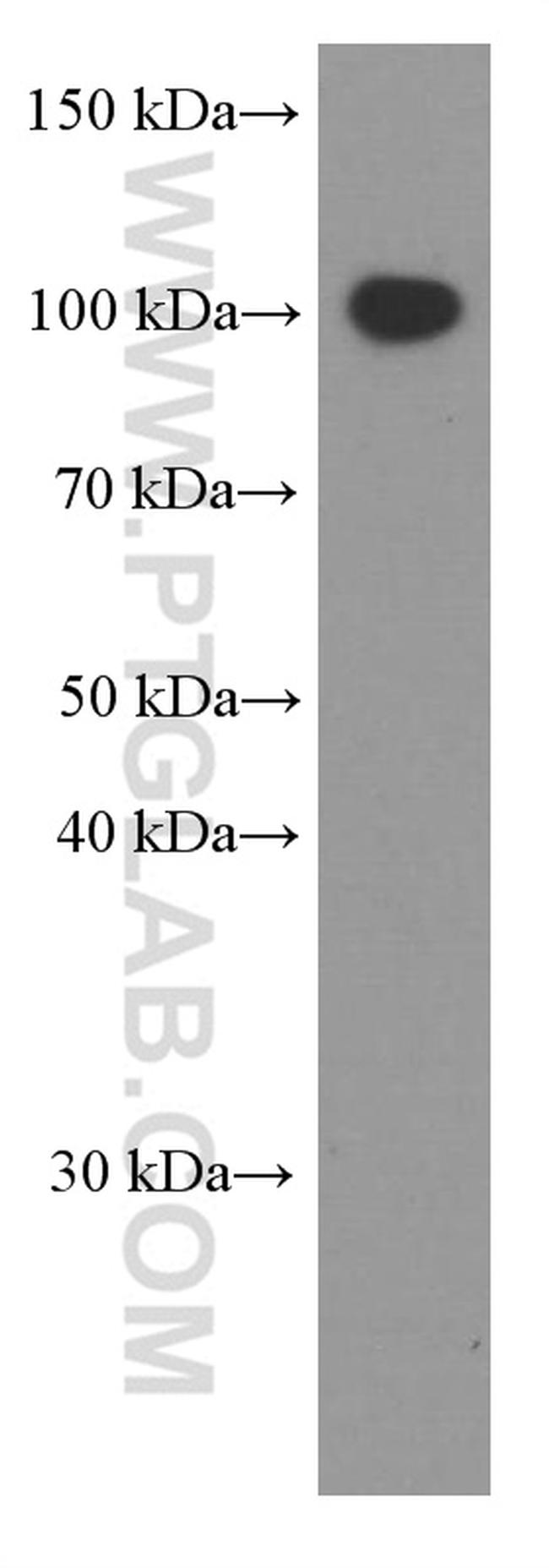 VCAM-1 Antibody in Western Blot (WB)