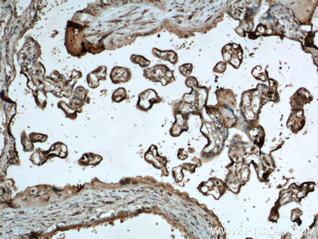 P-cadherin Antibody in Immunohistochemistry (Paraffin) (IHC (P))