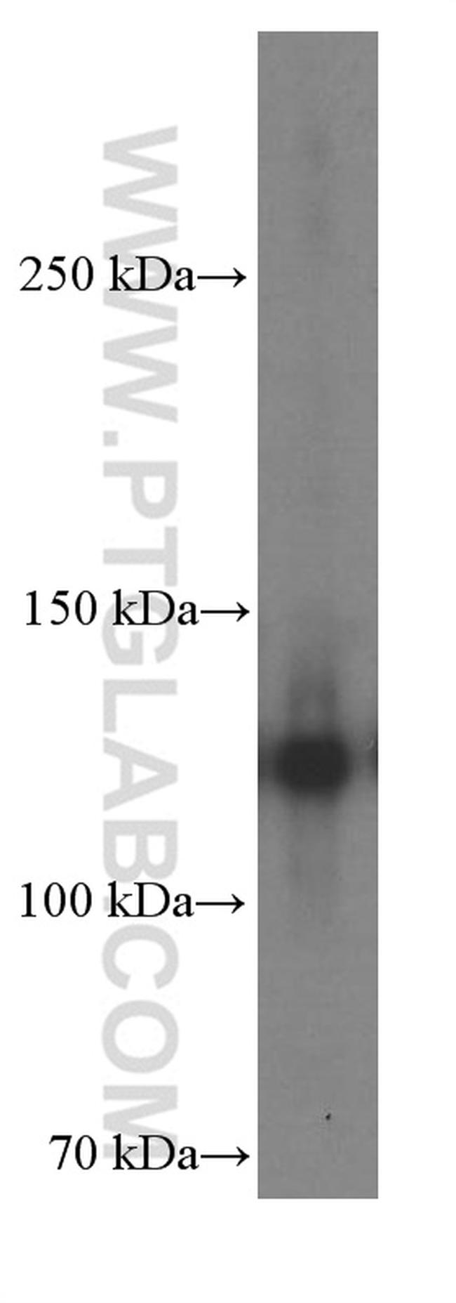 P-cadherin Antibody in Western Blot (WB)