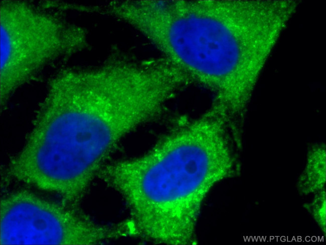 Sestrin2 Antibody in Immunocytochemistry (ICC/IF)