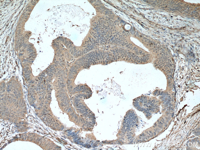 Sestrin2 Antibody in Immunohistochemistry (Paraffin) (IHC (P))