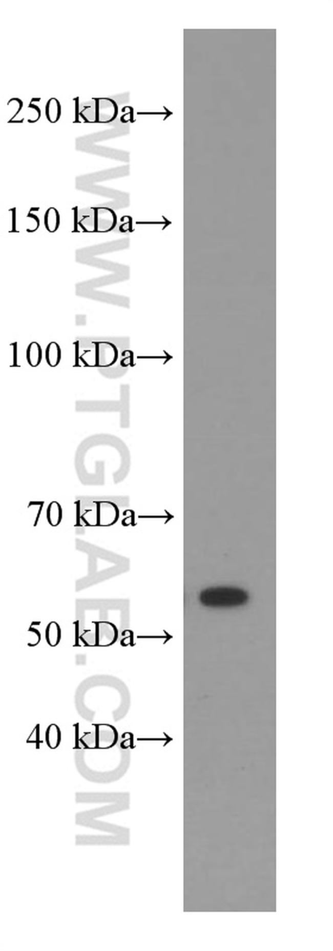 Sestrin2 Antibody in Western Blot (WB)