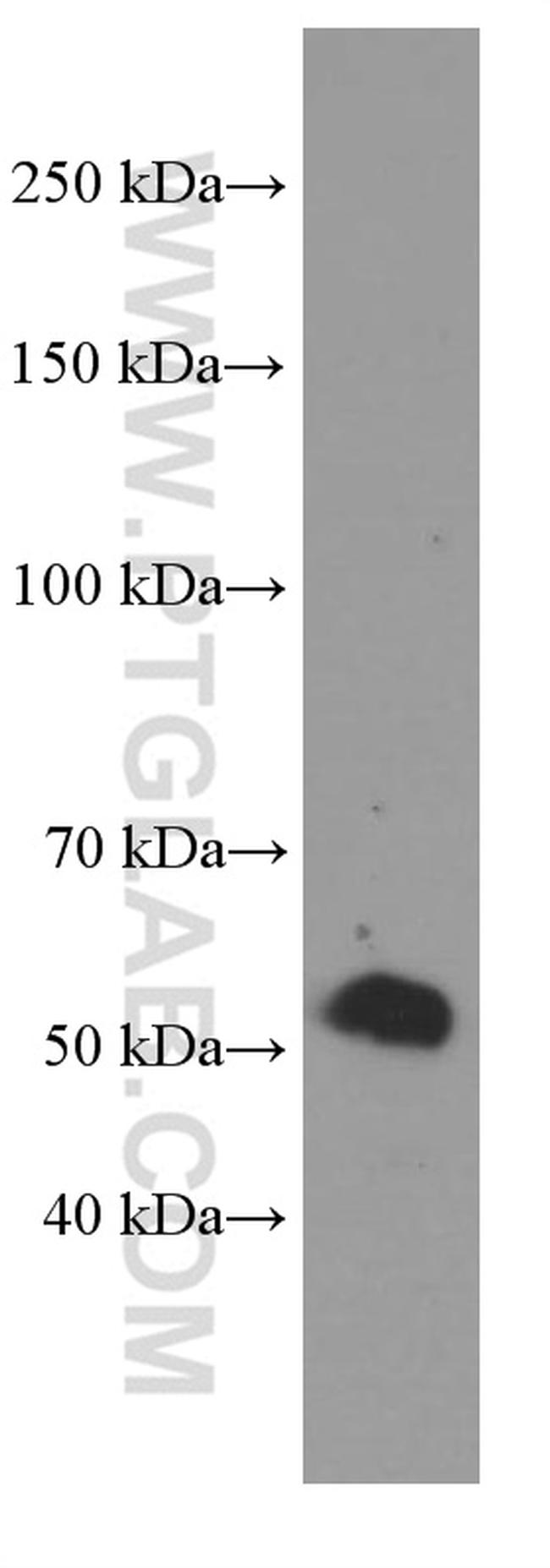 Sestrin2 Antibody in Western Blot (WB)