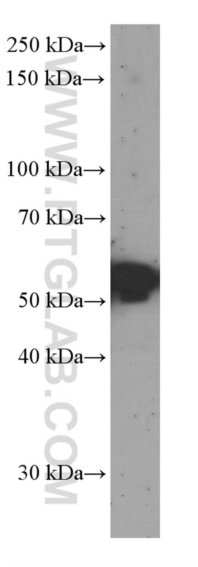 Sestrin2 Antibody in Western Blot (WB)