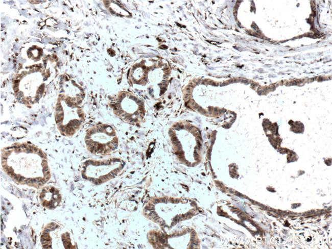 FABP5 Antibody in Immunohistochemistry (Paraffin) (IHC (P))