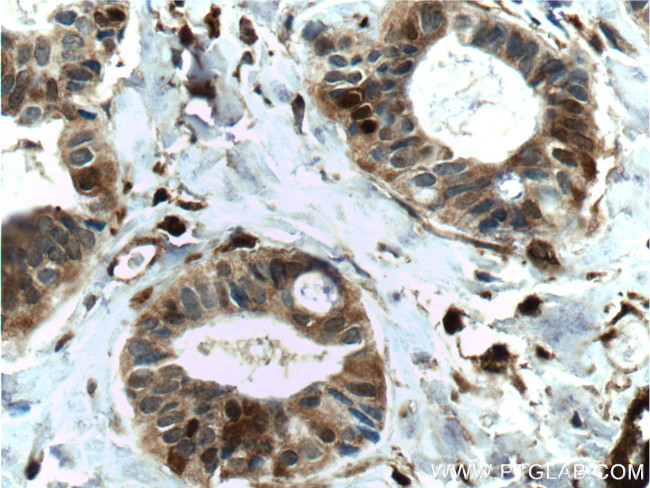 FABP5 Antibody in Immunohistochemistry (Paraffin) (IHC (P))