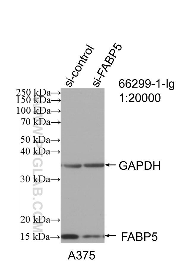 FABP5 Antibody in Western Blot (WB)