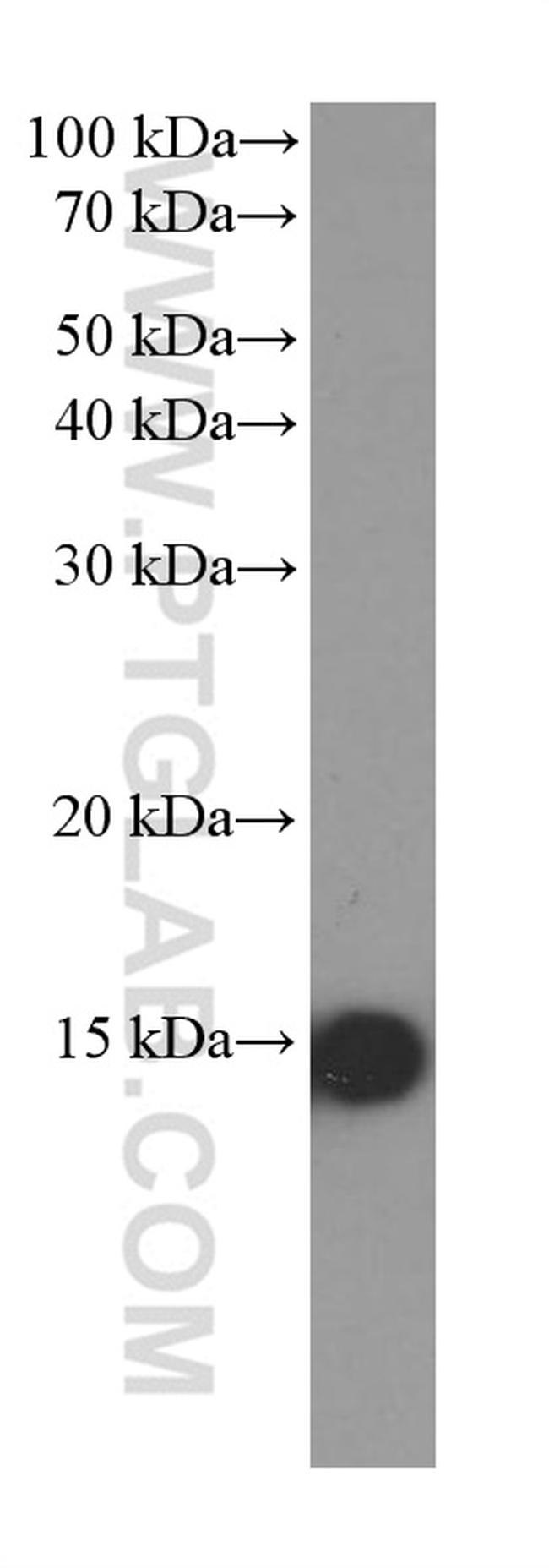 FABP5 Antibody in Western Blot (WB)