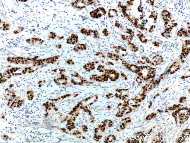 PR Antibody in Immunohistochemistry (Paraffin) (IHC (P))