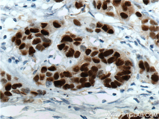 PR Antibody in Immunohistochemistry (Paraffin) (IHC (P))