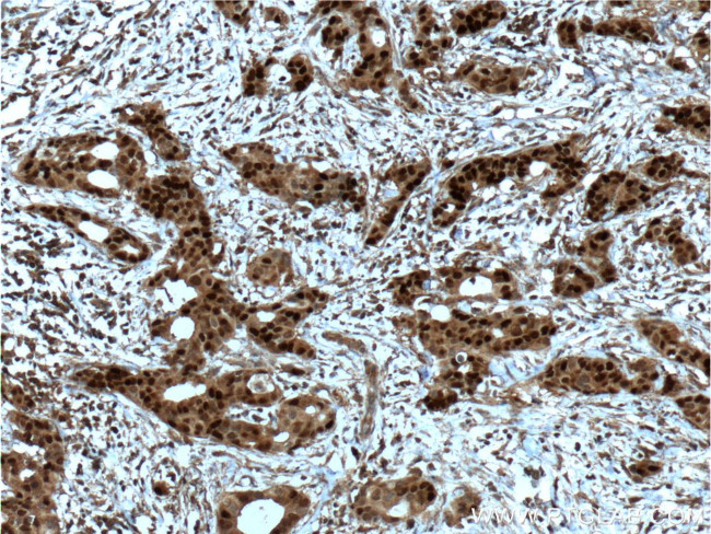 PR Antibody in Immunohistochemistry (Paraffin) (IHC (P))