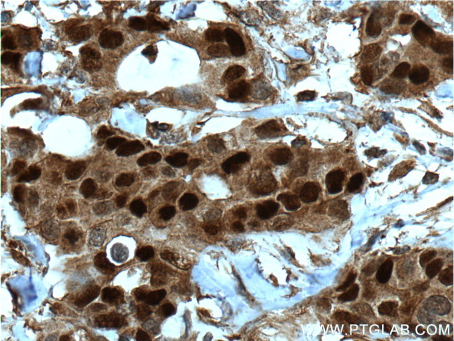 PR Antibody in Immunohistochemistry (Paraffin) (IHC (P))